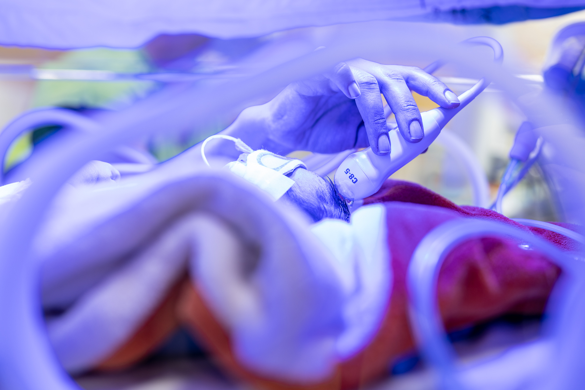 Modernizace a obnova přístrojů pro zvýšení kvality vysoce specializované péče v oboru perinatologie v Nemocnici České Budějovice, a.s.